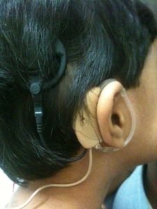 cochlear implant program, maurya foundation